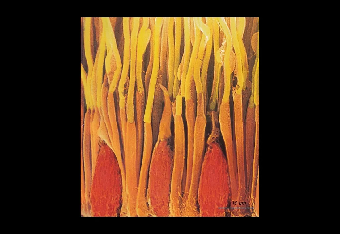 Retina